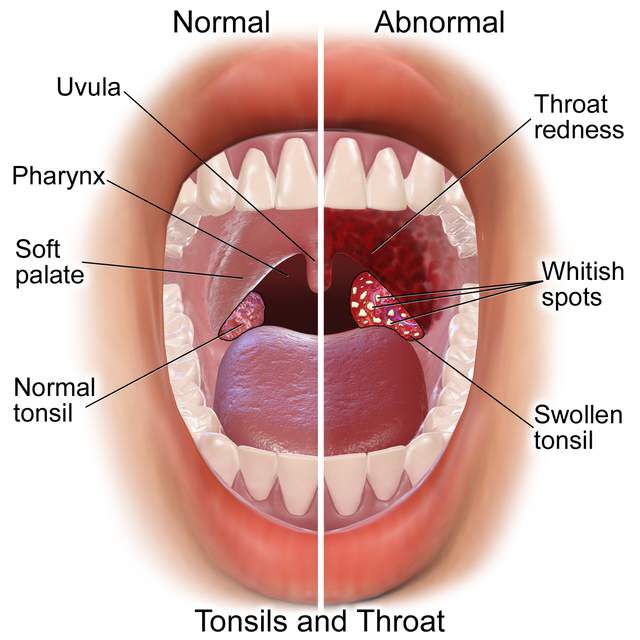 Dr Thomas Auricare Ent Clinic ENGAPUZHA